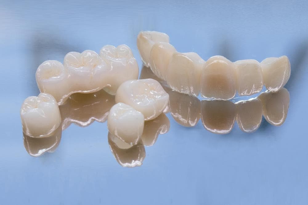 7 ventajas de las coronas de zirconio  - Imagen 1