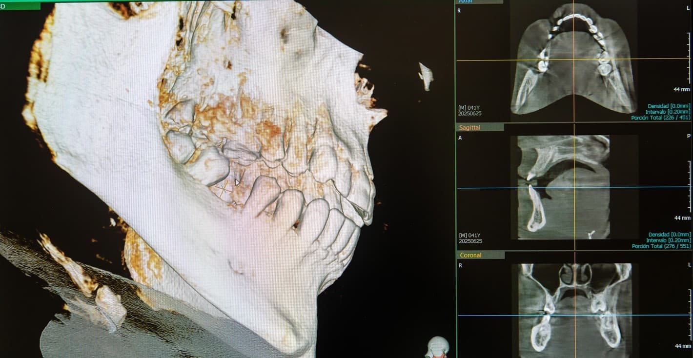 Lo mejor en tecnología dental